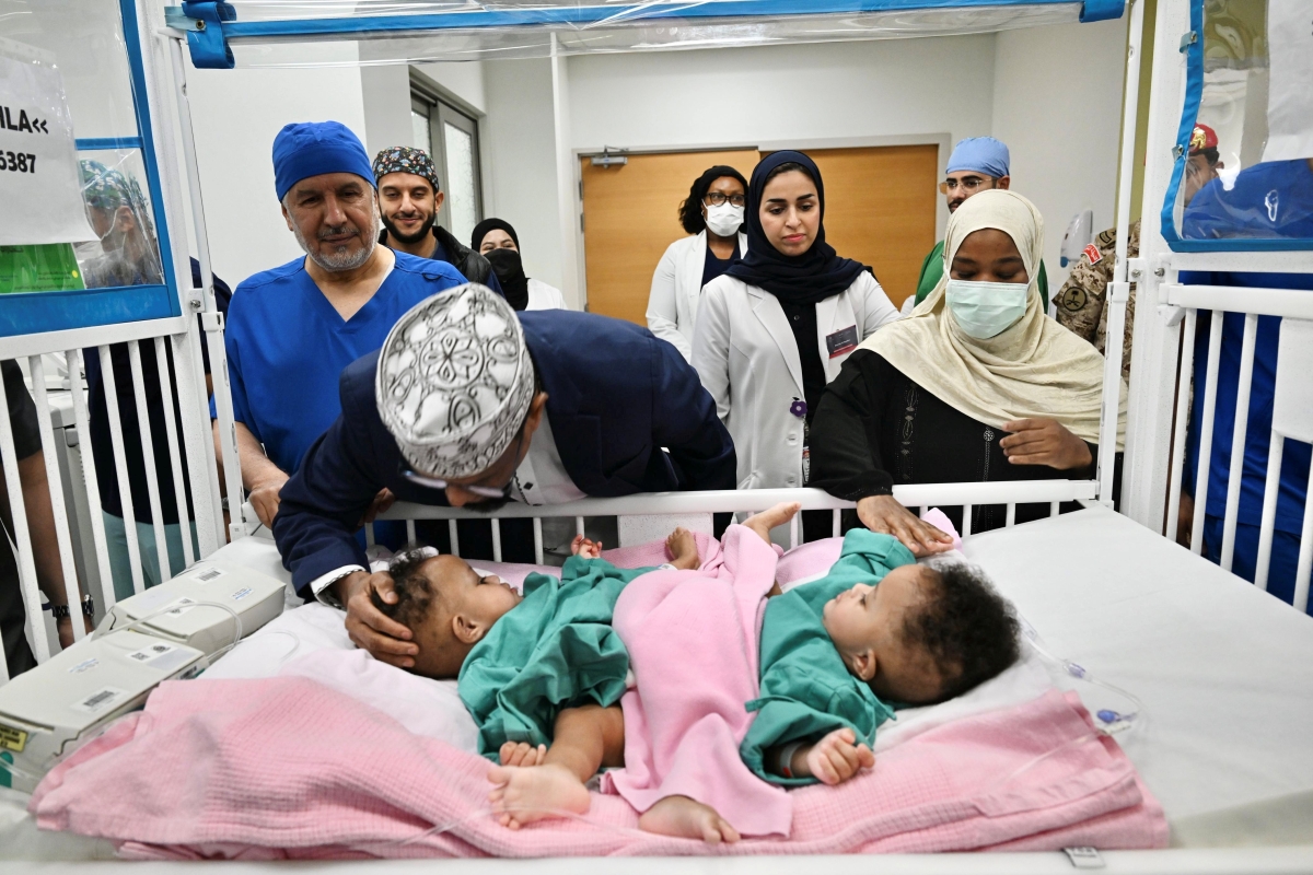 &nbsp;بدء عملية فصل التوأم الملتصق الصومالي &laquo;رحمة ورملا&raquo;