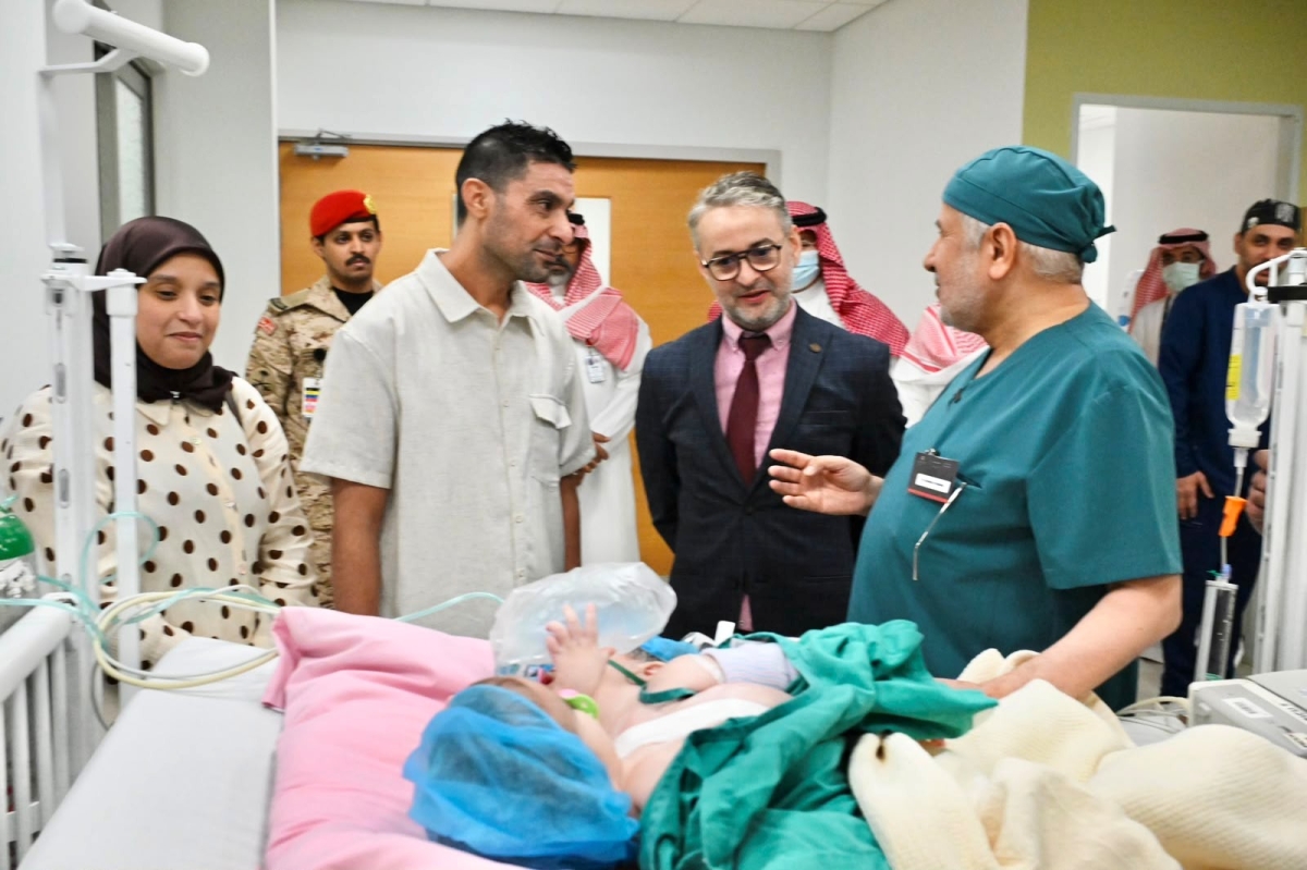 بدء عملية فصل التوأم الملتصق المغربي سجى وضحى