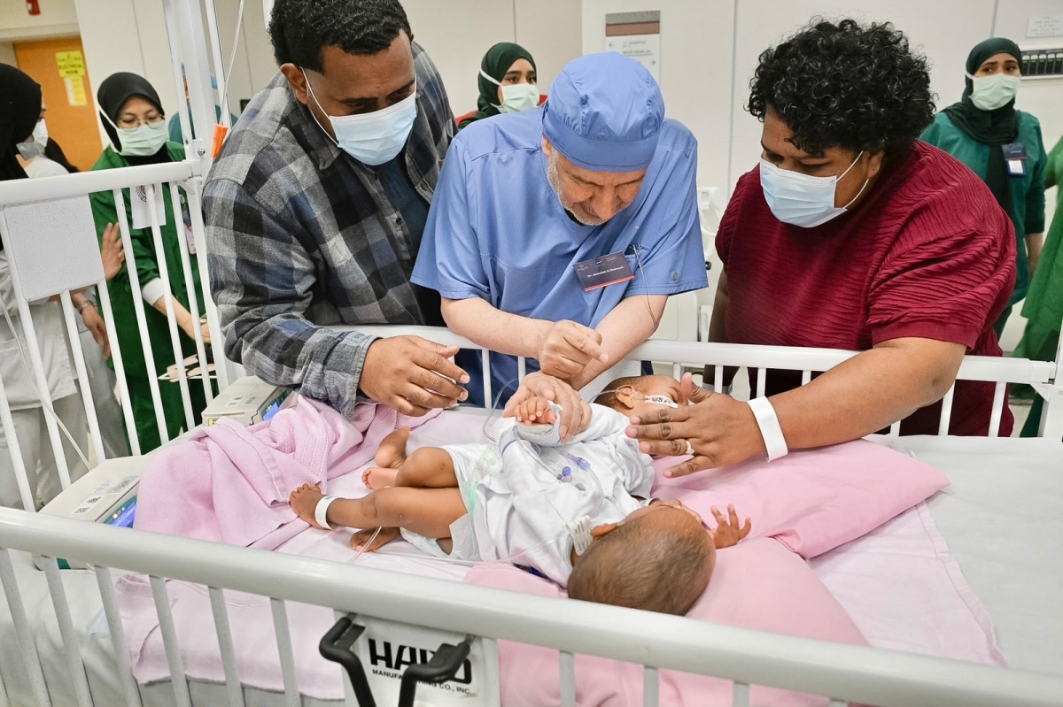 بدء عملية فصل التوأم الملتصق الفيجي جسبيلي وديسيسيا