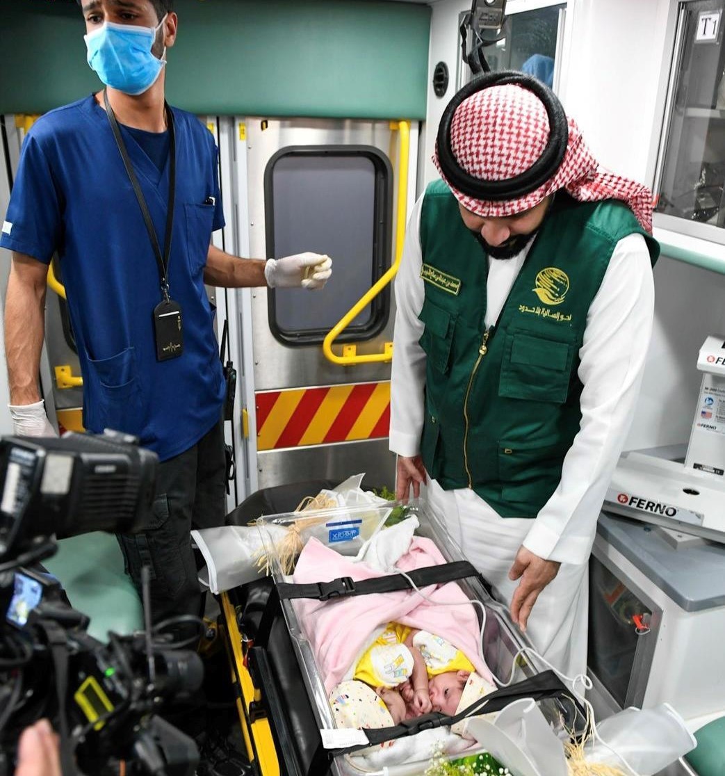 إنفاذاً لتوجيهات الملك.. إجراء عملية فصل التوأم السيامي اليمني مودة ورحمة الخميس المقبل